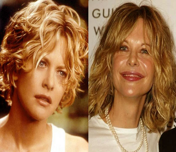 Plastic Surgery Effects on Hollywood Celebrities